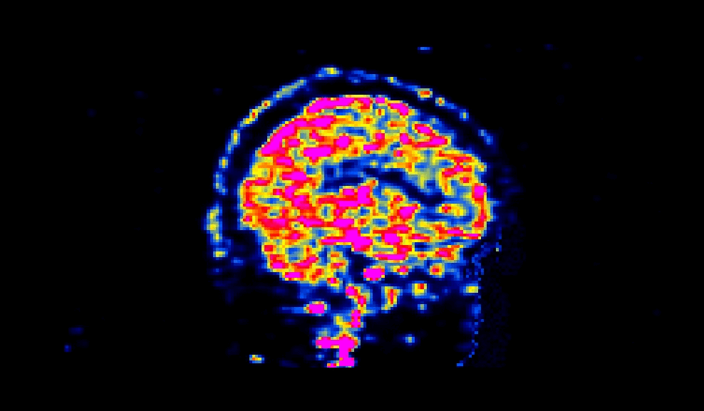_images/sagittal.gif